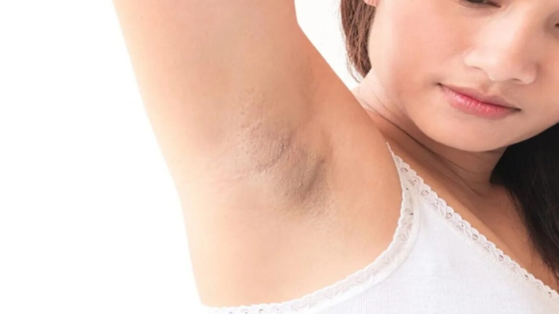 Alum For Dark Underarms: अंडर आर्म्स के कालेपन से छुटकारा पाने के लिए अपनाए यह घरेलू उपाय