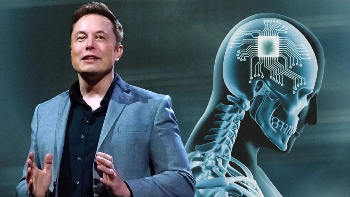 Elon Musk की चिप लगेगी इंसानी दिमाग में, जानें क्यों हुए हजारों लोग तैयार