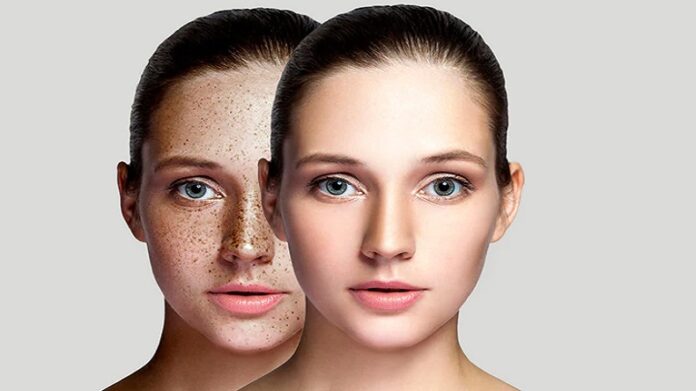 Skin Care: